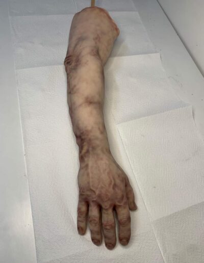 SEVERED ARM 1